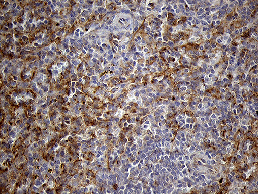 IFITM2 Antibody - Immunohistochemical staining of paraffin-embedded Human spleen tissue within the normal limits using anti-IFITM2 mouse monoclonal antibody. (Heat-induced epitope retrieval by 1mM EDTA in 10mM Tris buffer. (pH8.5) at 120°C for 3 min. (1:2000)