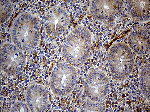 IFITM2 Antibody - Immunohistochemical staining of paraffin-embedded Human appendix tissue within the normal limits using anti-IFITM2 mouse monoclonal antibody. (Heat-induced epitope retrieval by 1mM EDTA in 10mM Tris buffer. (pH8.5) at 120°C for 3 min. (1:2000)