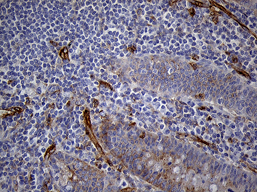IFITM2 Antibody - Immunohistochemical staining of paraffin-embedded Human appendix tissue within the normal limits using anti-IFITM2 mouse monoclonal antibody. (Heat-induced epitope retrieval by 1mM EDTA in 10mM Tris buffer. (pH8.5) at 120°C for 3 min. (1:1000)