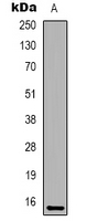 IFITM2 Antibody - Western blot analysis of IFITM2 expression in HeLa (A) whole cell lysates.
