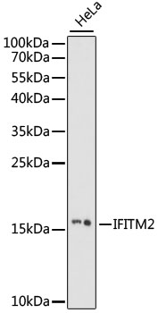 IFITM2 Antibody - Western blot analysis of extracts of HeLa cells, using IFITM2 antibody at 1:1000 dilution. The secondary antibody used was an HRP Goat Anti-Rabbit IgG (H+L) at 1:10000 dilution. Lysates were loaded 25ug per lane and 3% nonfat dry milk in TBST was used for blocking. An ECL Kit was used for detection and the exposure time was 60s.