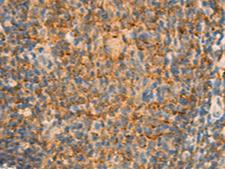 IFITM2 Antibody - Immunohistochemistry of paraffin-embedded Human tonsil tissue  using IFITM2 Polyclonal Antibody at dilution of 1:25(×200)
