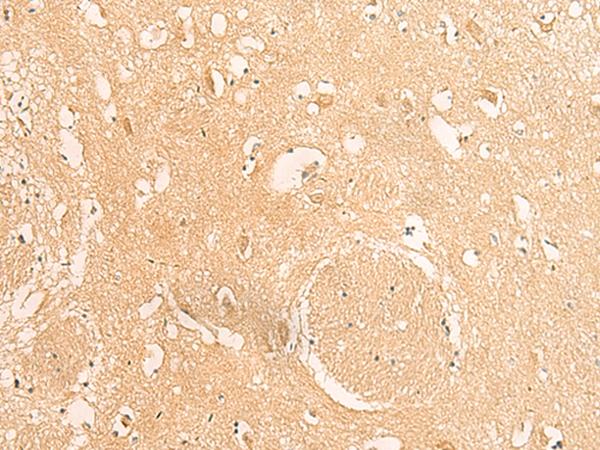 IFITM2 Antibody - Immunohistochemistry of paraffin-embedded Human brain tissue  using IFITM2 Polyclonal Antibody at dilution of 1:25(×200)