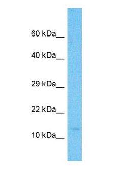 IFITM2 Antibody - Western blot of IFM2 Antibody with human HeLa Whole Cell lysate.  This image was taken for the unconjugated form of this product. Other forms have not been tested.