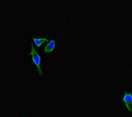 IFITM5 Antibody - Immunofluorescent analysis of Hela cells diluted at 1:100 and Alexa Fluor 488-congugated AffiniPure Goat Anti-Rabbit IgG(H+L)