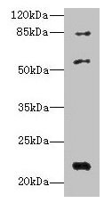 IFIX / PYHIN1 Antibody - Western blot All lanes: PYHIN1 antibody at 6µg/ml + Mouse small intestine tissue Secondary Goat polyclonal to rabbit IgG at 1/10000 dilution Predicted band size: 56, 55, 52, 51, 27, 26 kDa Observed band size: 56, 22, 84 kDa