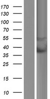 IFIX / PYHIN1 Protein - Western validation with an anti-DDK antibody * L: Control HEK293 lysate R: Over-expression lysate