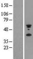 IFIX / PYHIN1 Protein - Western validation with an anti-DDK antibody * L: Control HEK293 lysate R: Over-expression lysate