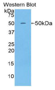 IFN Beta / Interferon Beta Antibody - Western blot of recombinant IFN Beta / Interferon Beta.  This image was taken for the unconjugated form of this product. Other forms have not been tested.