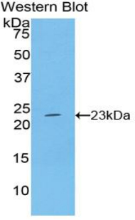 IFN Beta / Interferon Beta Antibody - Western blot of recombinant IFN Beta / Interferon Beta.