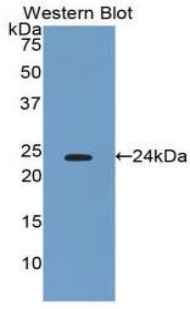 IFN Beta / Interferon Beta Antibody - Western blot of recombinant IFN Beta / Interferon Beta.