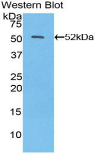 IFN Beta / Interferon Beta Antibody - Western blot of recombinant IFN Beta / Interferon Beta.