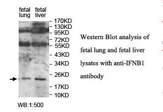IFN Beta / Interferon Beta Antibody