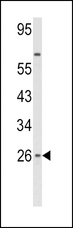 IFN Beta / Interferon Beta Antibody - Western blot of IFNB1 Antibody in HepG2 cell line lysates (35 ug/lane). IFNB1 (arrow) was detected using the purified antibody.
