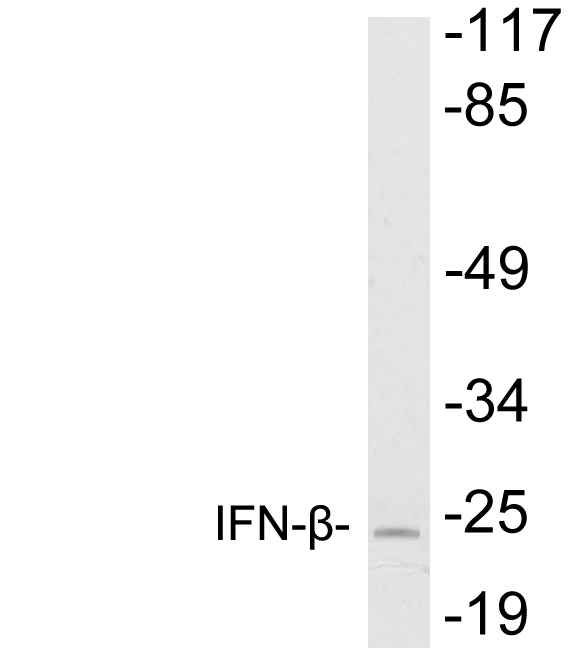 IFN Beta / Interferon Beta Antibody - Western blot analysis of lysates from HeLa cells, using IFN-Î² antibody.