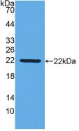 IFN Beta / Interferon Beta Antibody