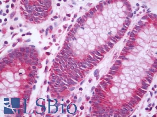 IFN Beta / Interferon Beta Antibody - Anti-IFN Beta / Interferon Beta antibody IHC staining of human colon. Immunohistochemistry of formalin-fixed, paraffin-embedded tissue after heat-induced antigen retrieval. Antibody concentration 10 ug/ml.  This image was taken for the unconjugated form of this product. Other forms have not been tested.