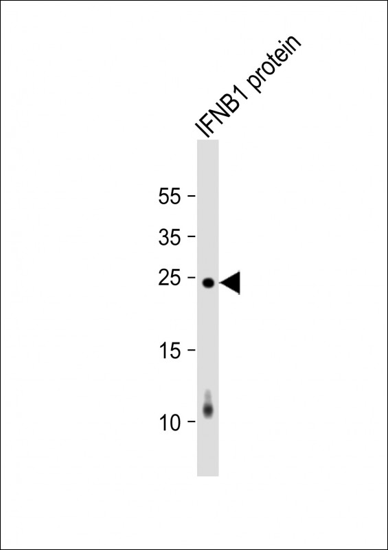 IFN Beta / Interferon Beta Antibody - Anti-IFNB1 Antibody at 1:2000 dilution + IFNB1 protein lysate Lysates/proteins at 20 µg per lane. Secondary Goat Anti-mouse IgG, (H+L), Peroxidase conjugated at 1/10000 dilution. Predicted band size: 23 kDa Blocking/Dilution buffer: 5% NFDM/TBST.