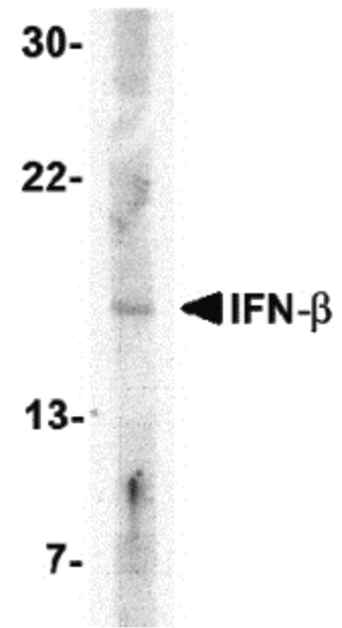 IFN Beta / Interferon Beta Antibody - Western blot of IFN-b in A-20 cell lysate with IFN-b antibody at 5 ug/ml.