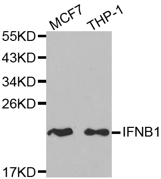 IFN Beta / Interferon Beta Antibody - Western blot analysis of extracts of various cell lines, using IFNB1 antibody at 1:1000 dilution. The secondary antibody used was an HRP Goat Anti-Rabbit IgG (H+L) at 1:10000 dilution. Lysates were loaded 25ug per lane and 3% nonfat dry milk in TBST was used for blocking.