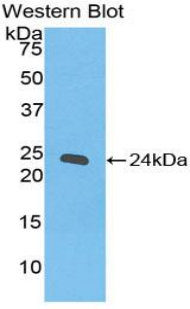 IFN Gamma / Interferon Gamma Antibody - Western blot of recombinant IFN Gamma / Interferon Gamma.  This image was taken for the unconjugated form of this product. Other forms have not been tested.