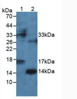 IFN Gamma / Interferon Gamma Antibody - Western Blot; Sample: Lane1: Mouse Lymphocyte Cells; Lane2: Human Leukocyte Cells.