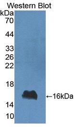IFN Gamma / Interferon Gamma Antibody - Western blot of IFN Gamma / Interferon Gamma antibody.