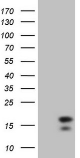 IFN Gamma / Interferon Gamma Antibody - HEK293T cells were transfected with the pCMV6-ENTRY control. (Left lane) or pCMV6-ENTRY IFNG. (Right lane) cDNA for 48 hrs and lysed. Equivalent amounts of cell lysates. (5 ug per lane) were separated by SDS-PAGE and immunoblotted with anti-IFNG.