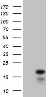 IFN Gamma / Interferon Gamma Antibody - HEK293T cells were transfected with the pCMV6-ENTRY control (Left lane) or pCMV6-ENTRY IFNG (Right lane) cDNA for 48 hrs and lysed. Equivalent amounts of cell lysates (5 ug per lane) were separated by SDS-PAGE and immunoblotted with anti-IFNG.