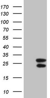 IFN Gamma / Interferon Gamma Antibody - HEK293T cells were transfected with the pCMV6-ENTRY control (Left lane) or pCMV6-ENTRY IFNG (Right lane) cDNA for 48 hrs and lysed. Equivalent amounts of cell lysates (5 ug per lane) were separated by SDS-PAGE and immunoblotted with anti-IFNG (1:2000).