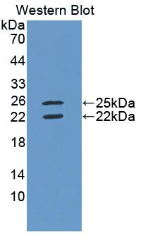 IFN Gamma / Interferon Gamma Antibody - Western blot of IFN Gamma / Interferon Gamma antibody.