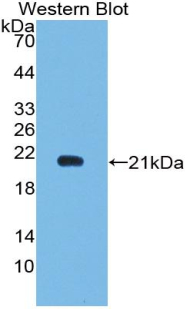 IFN Gamma / Interferon Gamma Antibody - Western blot of IFN Gamma / Interferon Gamma antibody.