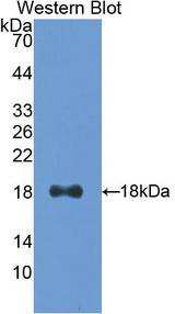 IFN Gamma / Interferon Gamma Antibody