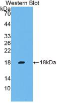 IFN Gamma / Interferon Gamma Antibody