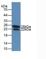 IFN Gamma / Interferon Gamma Antibody - Western Blot; Sample: Recombinant IFNg, Human.