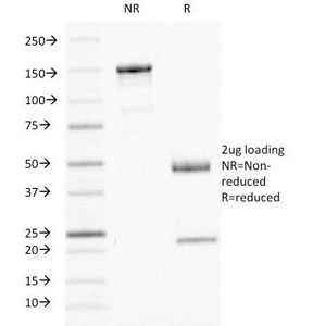 IFN Gamma / Interferon Gamma Antibody - SDS-PAGE Analysis of Purified, BSA-Free IFN gamma Antibody (clone IFNG/466). Confirmation of Integrity and Purity of the Antibody.
