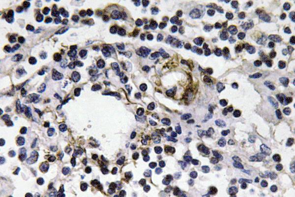 IFN Gamma / Interferon Gamma Antibody - IHC of IFN- (Q69) pAb in paraffin-embedded human lymph node tissue.
