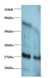 IFN Gamma / Interferon Gamma Antibody - Western blot of Interferon gamma antibody at 2 ug/ml. Lane 1: EC109whole cell lysate. Lane 2: 293T whole cell lysate. Secondary: Goat polyclonal to Rabbit IgG at 1:15000 dilution. Predicted band size: 18.3 kDa. Observed band size: 27 kDa Additional bands at: 70 kDa. We are unsure as to the identity of this extra band.  This image was taken for the unconjugated form of this product. Other forms have not been tested.