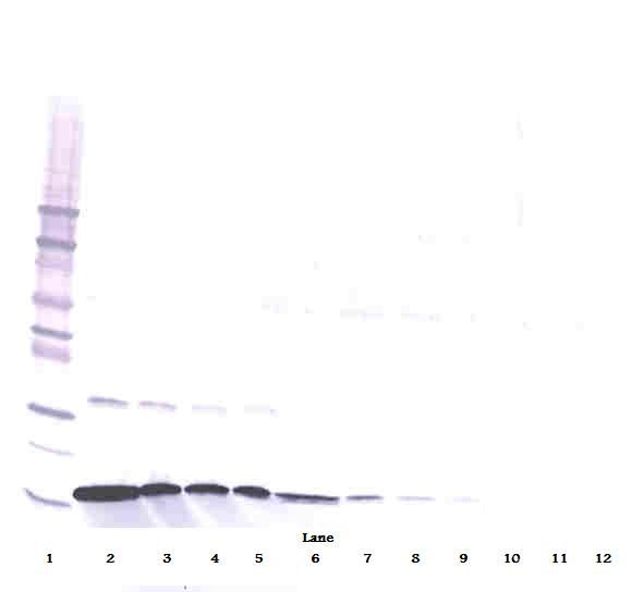IFN Gamma / Interferon Gamma Antibody - Western Blot (reducing) of IFN-Gamma / Interferon Gamma antibody
