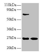 IFN Gamma / Interferon Gamma Antibody - Western blot All lanes: Interferon gamma ntibody at 2µg/ml Lane 1: EC109whole cell lysate Lane 2: 293T whole cell lysate Secondary Goat polyclonal to rabbit IgG at 1/15000 dilution Predicted band size: 18.3 kDa Observed band size: 27 kDa