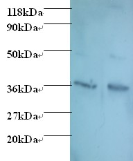 IFN Gamma / Interferon Gamma Antibody - Western blot of Interferon gamma antibody at 2 ug/ml. Lane 1: EC109 whole cell lysate. Lane 2: 293T whole cell lysate. Secondary: Goat polyclonal to Rabbit IgG at 1:15000 dilution. Predicted band size: 18.3 kDa. Observed band size: 36 kDa Additional bands at: 45 kDa. We are unsure as to the identity of this extra band.  This image was taken for the unconjugated form of this product. Other forms have not been tested.