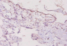 IFN Gamma / Interferon Gamma Antibody - Immunohistochemistry of paraffin-embedded human placenta tissue using Ifng Antibody at dilution of 1:20