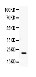 IFN Gamma / Interferon Gamma Antibody - Western blot - Anti-IFN gamma Antibody