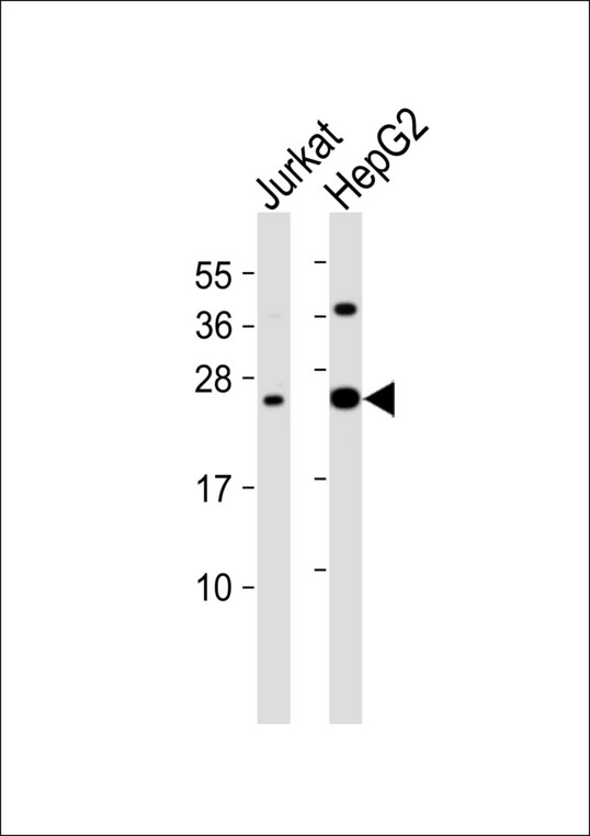 IFN Gamma / Interferon Gamma Antibody - All lanes : Anti-Interferon gamma Antibody at 1:1000 dilution Lane 1: Jurkat whole cell lysates Lane 2: HepG2 whole cell lysates Lysates/proteins at 20 ug per lane. Secondary Goat Anti-Rabbit IgG, (H+L),Peroxidase conjugated at 1/10000 dilution Predicted band size : 19 kDa Blocking/Dilution buffer: 5% NFDM/TBST.