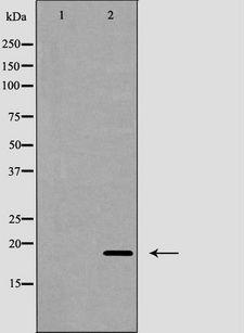 IFN Gamma / Interferon Gamma Antibody - Western blot analysis of Interferon gamma expression in HepG2 cells,. The lane on the left is treated with the antigen-specific peptide.