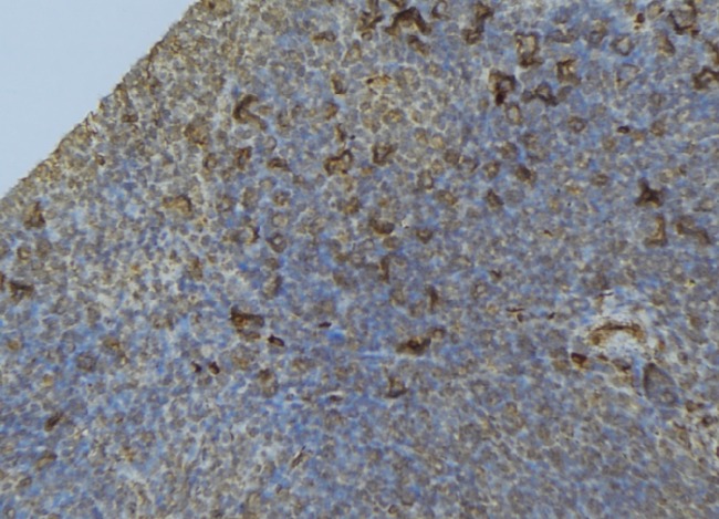 IFN Gamma / Interferon Gamma Antibody - 1:100 staining human lymph node tissue by IHC-P. The sample was formaldehyde fixed and a heat mediated antigen retrieval step in citrate buffer was performed. The sample was then blocked and incubated with the antibody for 1.5 hours at 22°C. An HRP conjugated goat anti-rabbit antibody was used as the secondary.