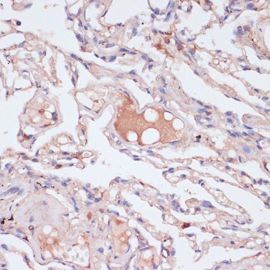 Anti-IFN Gamma / Interferon Gamma Antibody | Rabbit anti-Human IHC | LSBio