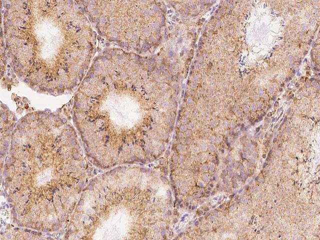 IFN Gamma / Interferon Gamma Antibody - Immunochemical staining of mouse IFNG in mouse testis with rabbit polyclonal antibody at 1:500 dilution, formalin-fixed paraffin embedded sections.