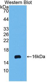 IFNA / Interferon Alpha Antibody - Western blot of IFNA / Interferon Alpha antibody.