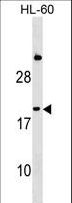 IFNA1 / Interferon Alpha 1 Antibody - IFNA1 Antibody western blot of HL-60 cell line lysates (35 ug/lane). The IFNA1 antibody detected the IFNA1 protein (arrow).